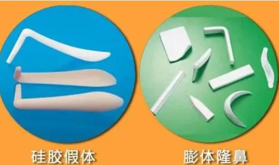 ���w¡���ӹ��z��߀�����w��?����ʲô��(y��u)ȱ�c