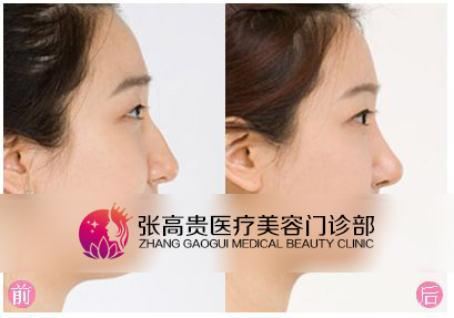 ��ǳC��ǰ�󌦱�