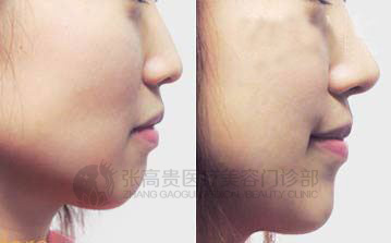 ��ǳC��ǰ�󌦱�