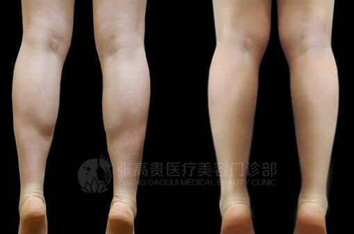 ���ͺ��������