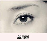 呼和浩特市新月型雙眼皮