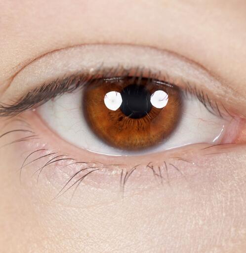 上瞼下垂治療方法有哪些