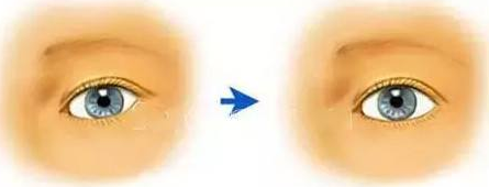 ���ϲ��´����g���L�U��