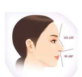 玻尿酸隆鼻的維持時間是多久