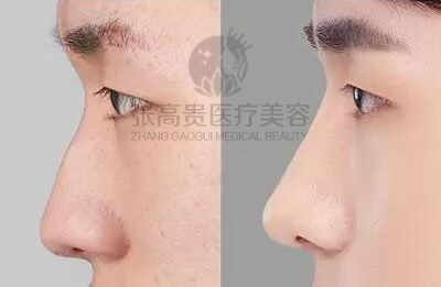 ���z���w