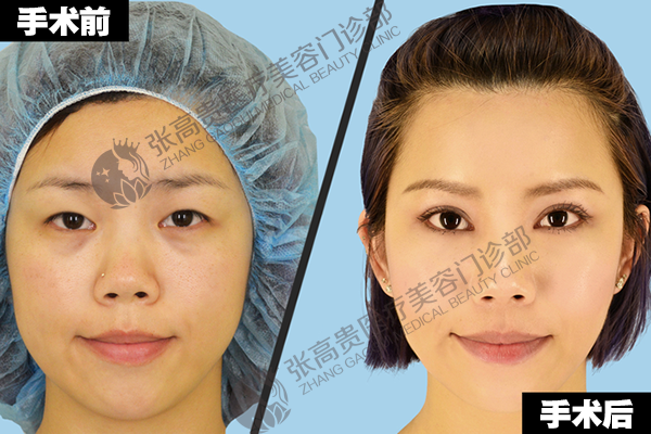 ���ͺ��؏����F�p��Ƥ���g(sh��)ǰ�󌦱���