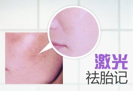 ���ͺ��ؼ������