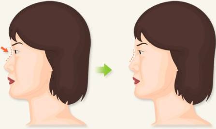 ���ͺ��������t(y��)Ժע��¡���F���F