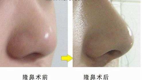 ���ͺ��������t(y��)Ժ���w¡�Ƕ����X(qi��n)��