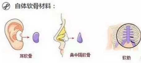 ���ͺ��������t(y��)Ժ���w¡����ʲô��(y��u)��(sh��)��