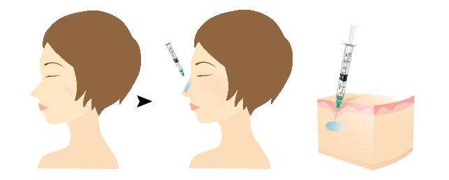 ���ͺ��������t(y��)Ժ¡������Щ�L(f��ng)�U(xi��n)��