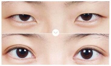 QQ�؈D20181226111413