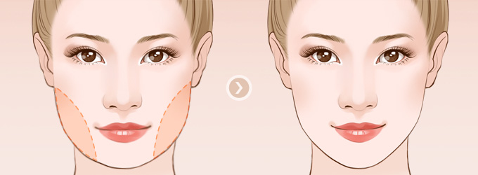 ���ͺ��������沿��֬�����X(qi��n)