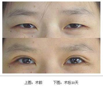 ���ͺ����p��Ƥ���θ��p��Ƥ��߀���񾀺���