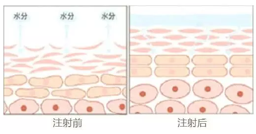 ע����ˮ��ᘺ��ע�����