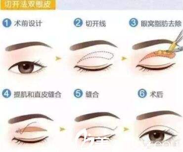 呼市整形醫(yī)院