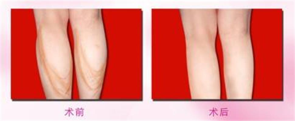 ���ͺ������Ȳ���֬���g(sh��)�����X