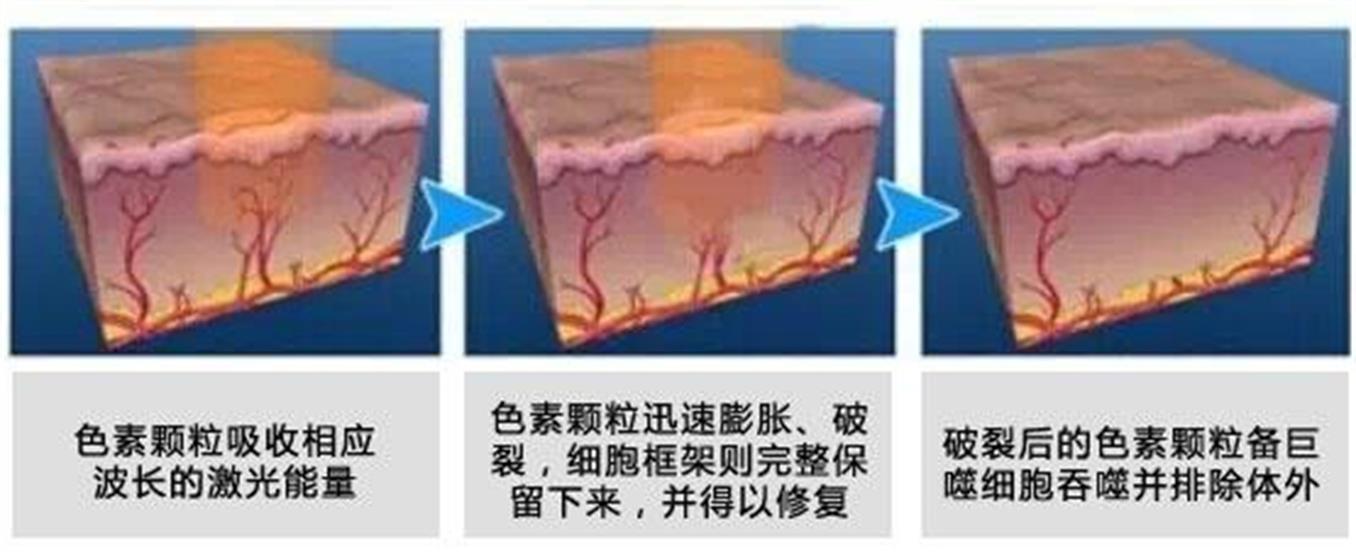 ���ͺ��ؼ�����̥ӛ�����X