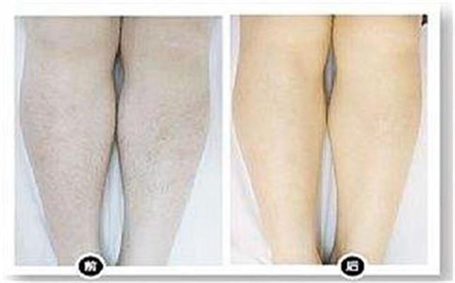 ���c(di��n)Óë�����X