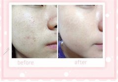 ���ͺ���������Q�w�����X(qi��n)?