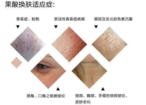 ���ͺ��ع���Q�wЧ�����