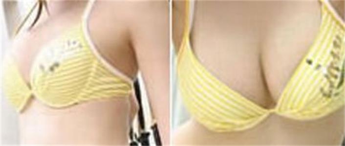 ���ͺ������w֬���S��Ч����ô��