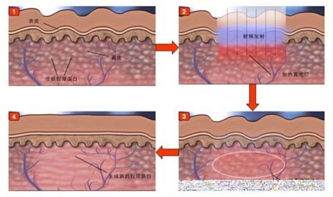 ���ͺ����ļ��t(y��)Ժ��̥ӛЧ����