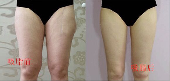 ���ͺ������ļҳ�֬����Ч����