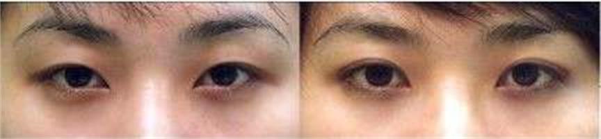 ���ͺ��������p��Ƥ�����X