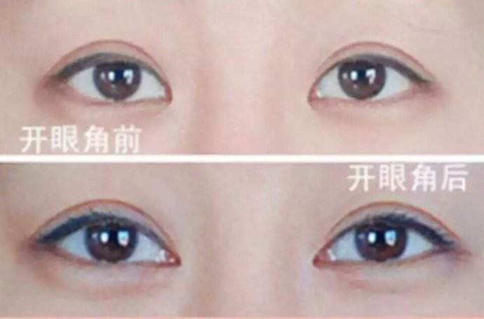 ���ͺ������_(k��i)�۽����g(sh��)�����X(qi��n)?