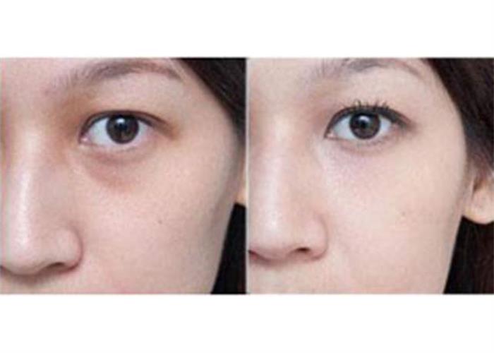 ���ͺ������������۴����g(sh��)�����X