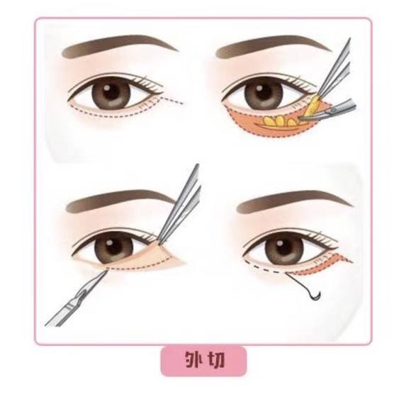 ���ͺ����ļ������۴�Ч����