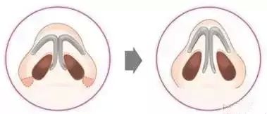 �����sС���g(sh��)�ăr�����