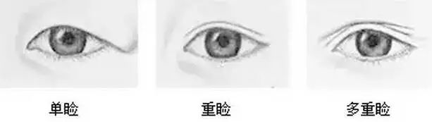 呼和浩特哪家醫(yī)院割雙眼皮效果好