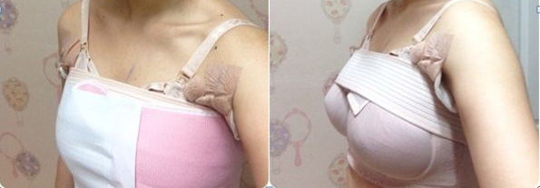 ���ͺ������w֬���S�����g(sh��)Ч���ò���