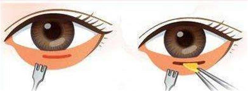 ���ͺ��������t(y��)Ժ�����۴����g(sh��)�����X