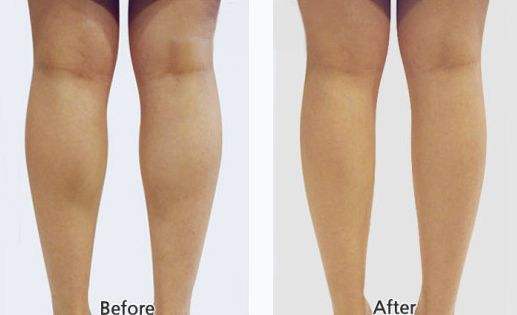 ���ͺ����ļ��t(y��)Ժע������Ч����