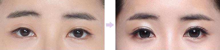 ���ͺ����p��Ƥ�ޏ�(f��)�ļҺ�