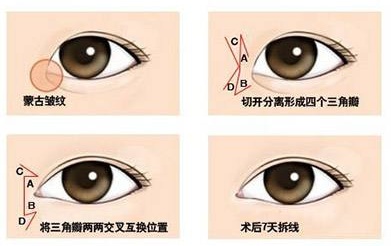 timg_���D��