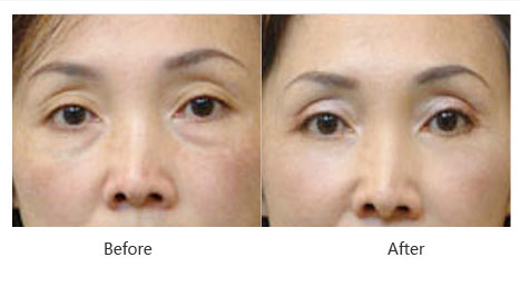 ���ͺ������۴������X