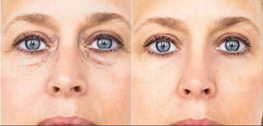 ΢�ňDƬ_20190609103122