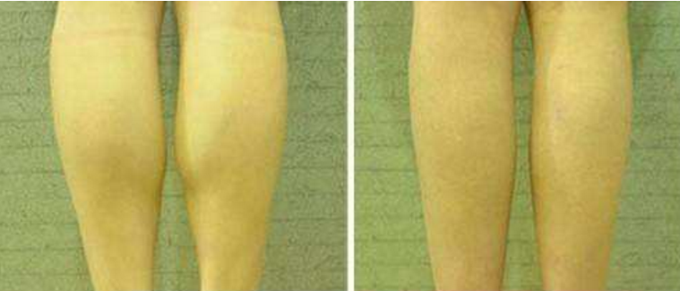 ΢�ňDƬ_20190609110009