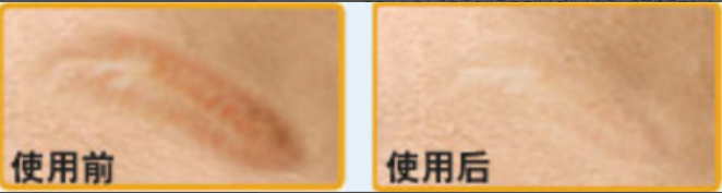 ����ȥ�̺۶����X��