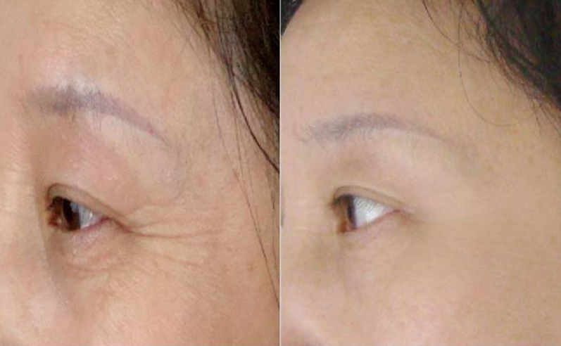 ΢�ňDƬ_20190610142151