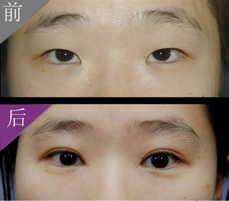 �p��Ƥ�ޏ�(f��)��ô��