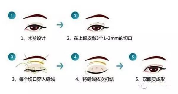 ���ͺ�������ʽ���c(di��n)�p��Ƥ���g(sh��)��Ŷ����X