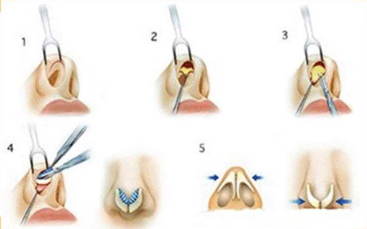 ΢�ňDƬ_20190617164925