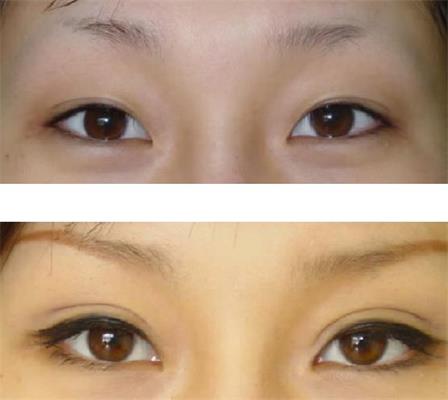 ���ͺ������p��Ƥ��Ŷ����X