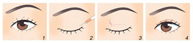 ���ͺ����ļ����nʽ�p��ƤЧ����