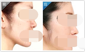 ���ͺ������wܛ��¡�Ƕ����X